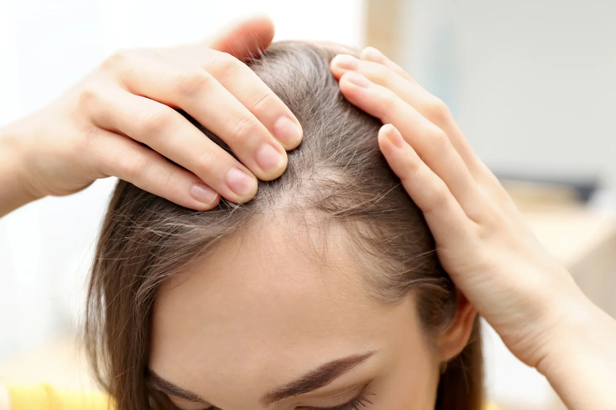 Shampoo hiustenlähtöön – toimiiko se oikeasti?
