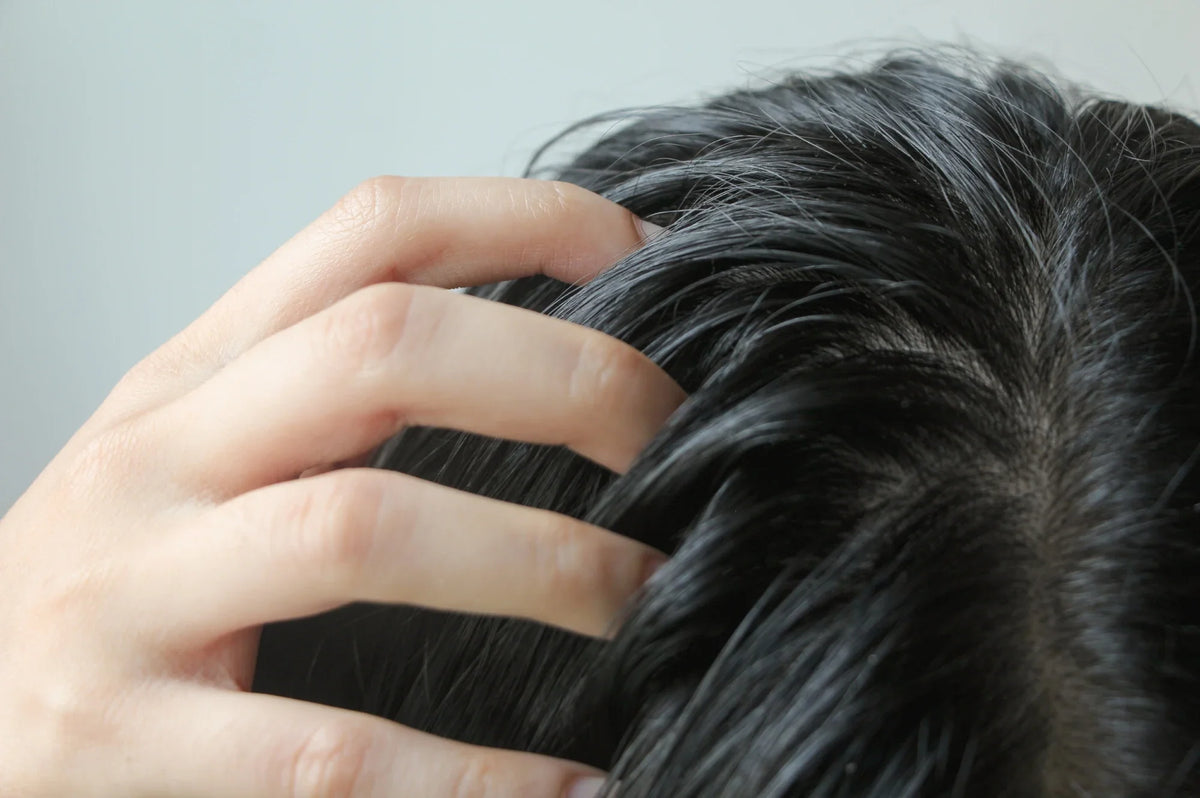Greasy hair and scalp