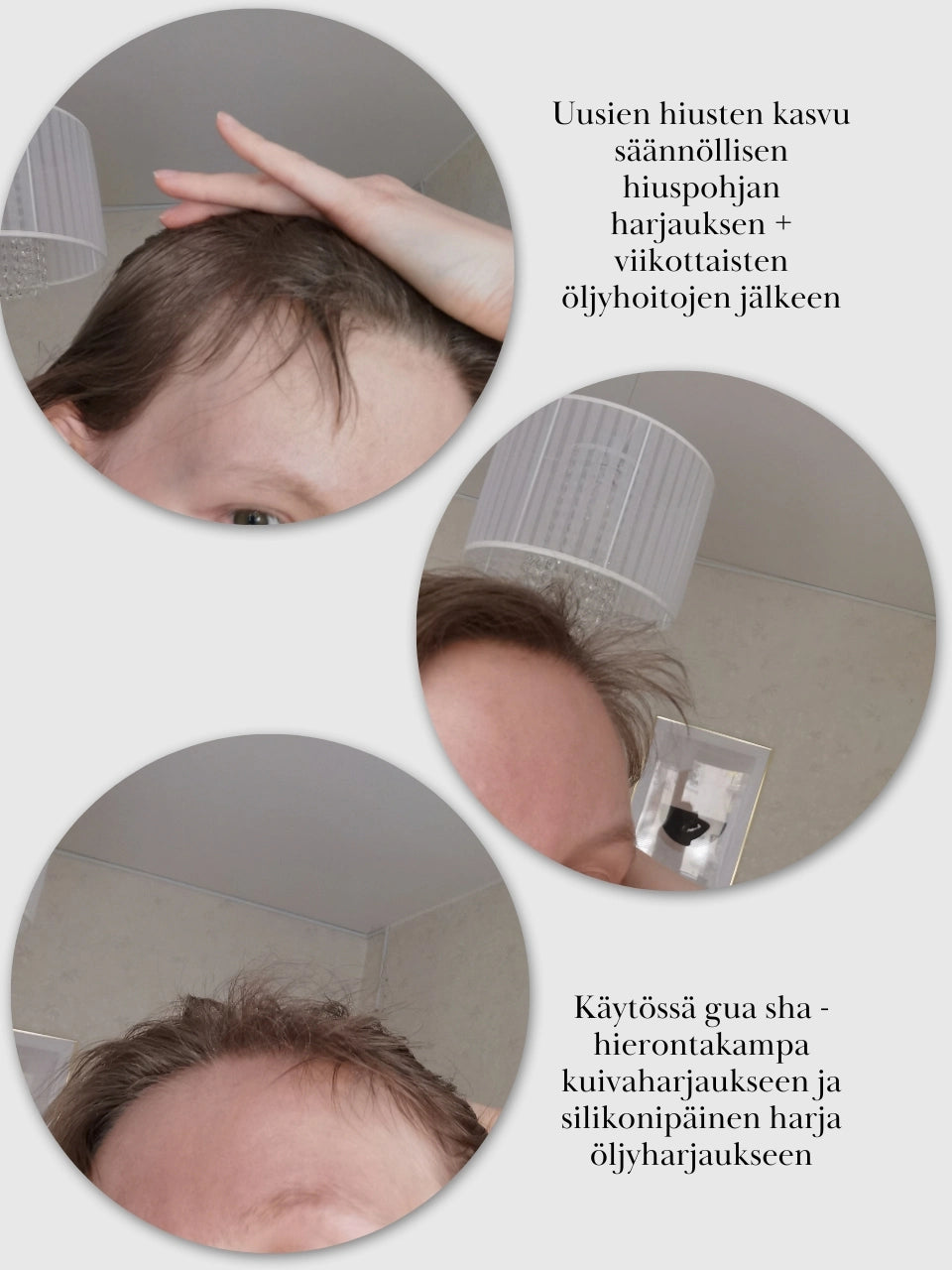 Uutta hiuskasvustoa