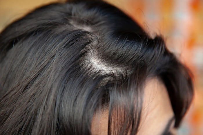 Jatkuvasti rasvoittuvat hiukset – näin saat rasvoittuvat hiukset kuriin
